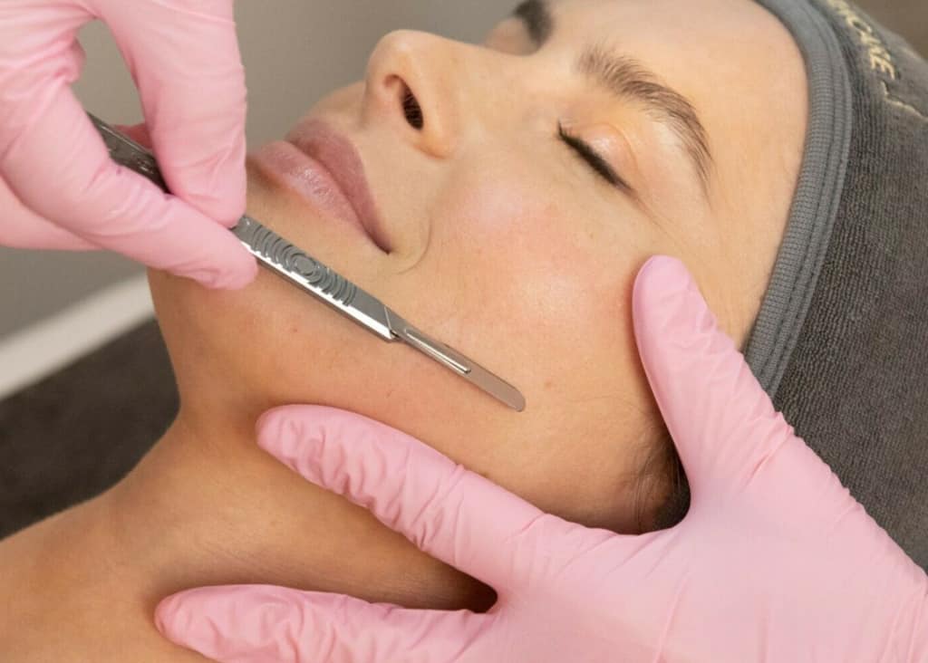 Benefits-of-Derma-Planing