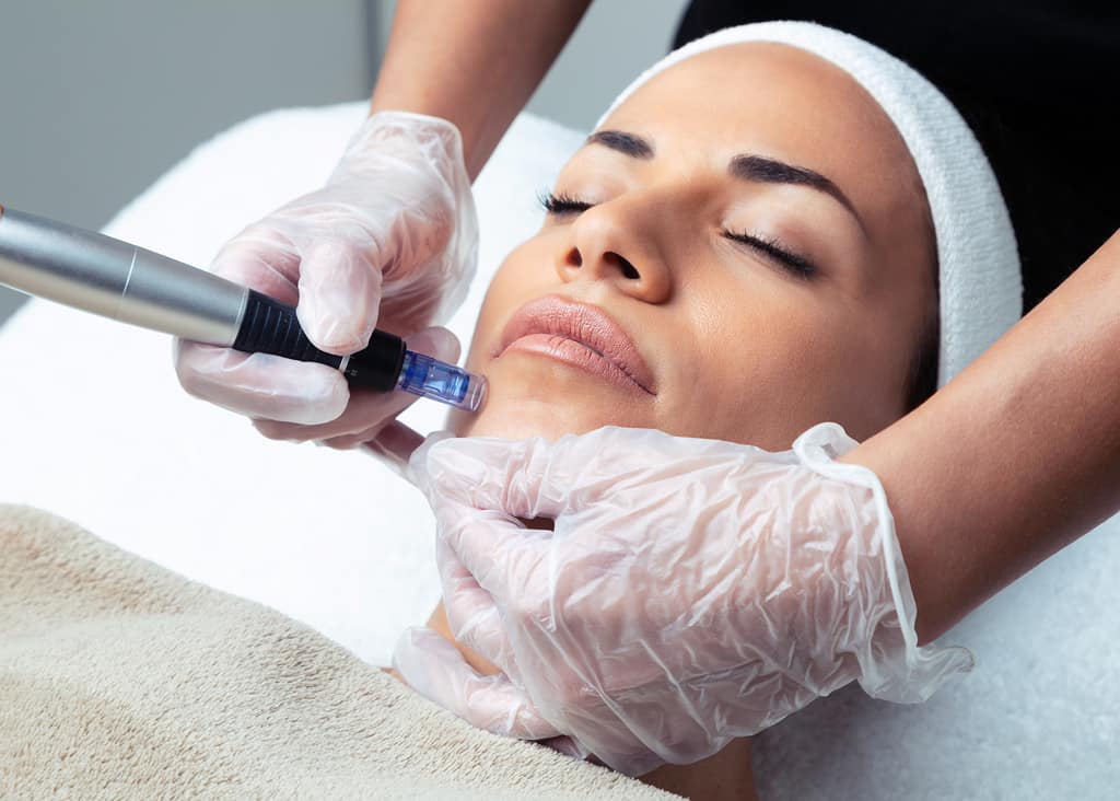 SkinPen (Microneedling)-min